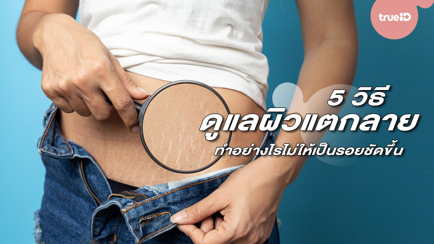 5 วิธีดูแล ผิวแตกลาย ทำอย่างไรไม่ให้เป็นรอยชัดขึ้น