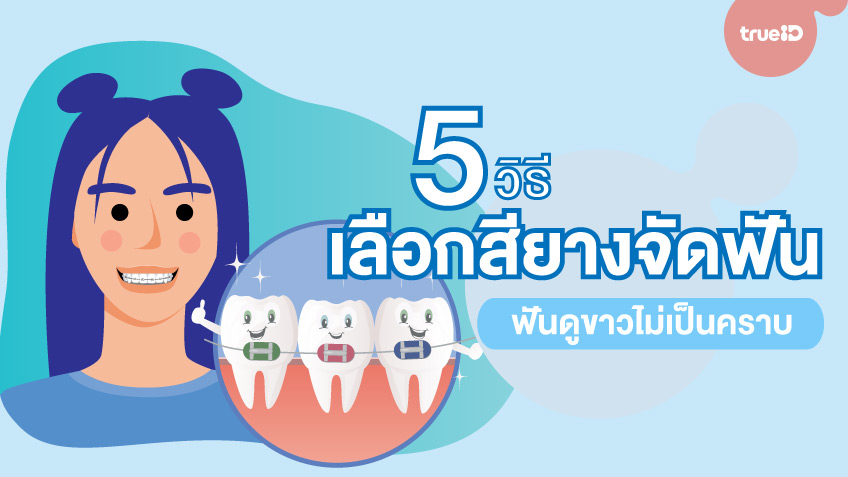5 วิธีเลือกสียางจัดฟัน เลือกสีอะไรให้ฟันดูขาว ไม่เหลือง ไม่ดำ
