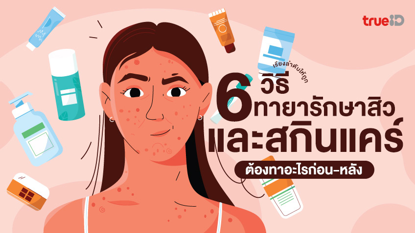 6 วิธีทายารักษาสิว และการลงสกินแคร์ เรียงลำดับให้ถูก ต้องทาอะไรก่อน-หลัง