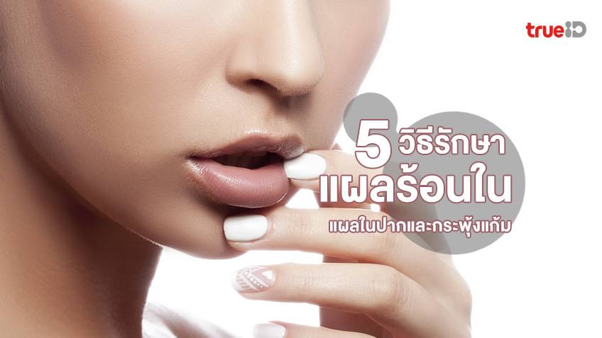 5 วิธีรักษาแผลร้อนใน แผลในปากและกระพุ้งแก้ม ที่ทั้งเจ็บและรำคาญ !!