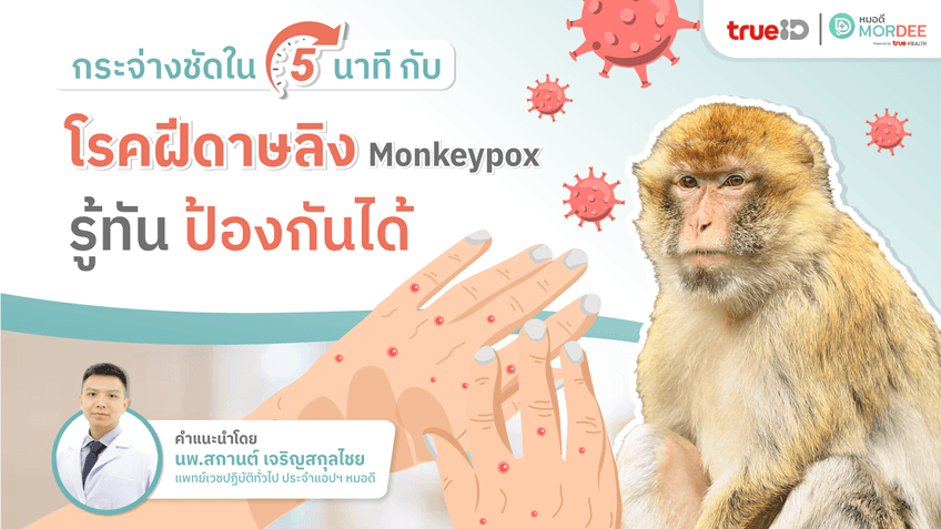 โรคฝีดาษลิงคืออะไร รู้ทัน สาเหตุ อาการ พร้อมวิธีป้องกันโรคฝีดาษลิง