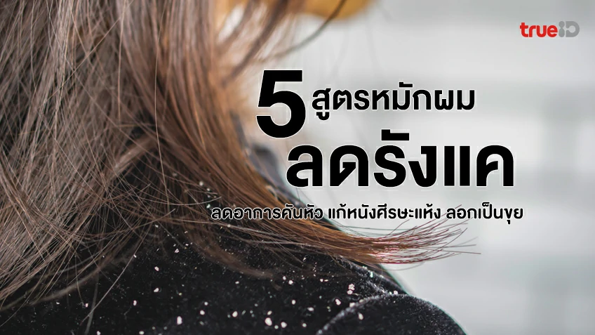 หนังศีรษะแห้ง - รวมสาระดีๆ ของผู้หญิง ที่เกี่ยวข้องกับ 