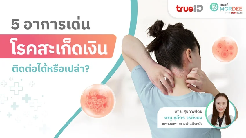 5 อาการเด่น #โรคสะเก็ดเงิน ติดต่อกันได้ไหม❓ คุณหมอมีคำตอบ👩‍⚕️