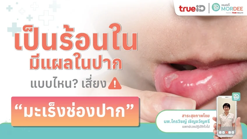 เป็น ร้อนใน มีแผลในปากแบบไหน❓  เสี่ยง❗ #มะเร็งช่องปาก 👄