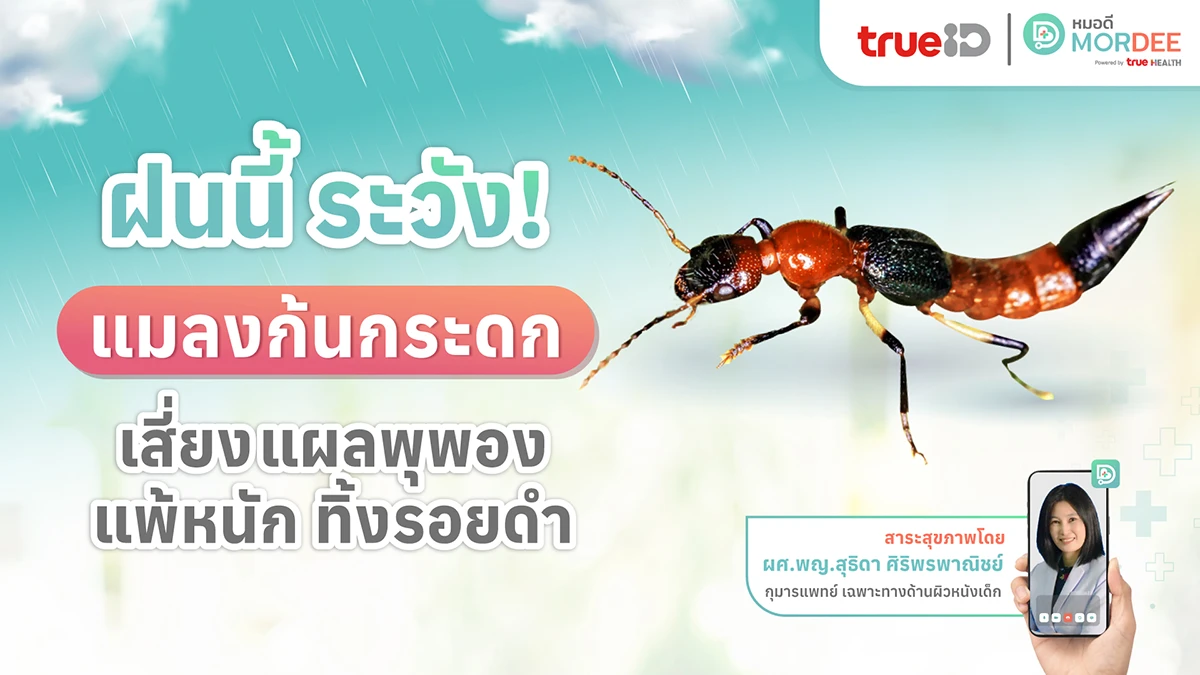 ฝนนี้ ระวัง! #แมลงก้นกระดก เจออย่าจับ❗ เสี่ยงแผลพุพอง แพ้หนัก ทิ้งรอยดำ